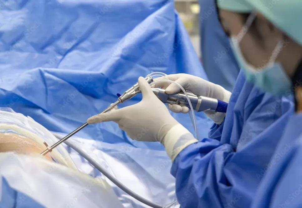 Spine Injection Image
