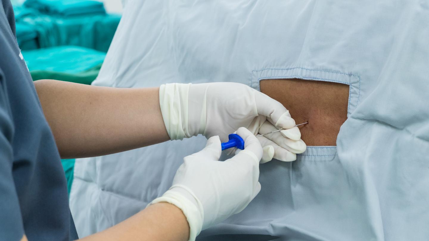 Lumbar Endoscopic Discectomy Treatment in New York