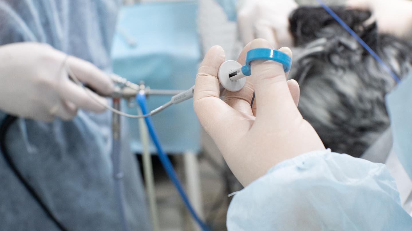 Radiofrequency Ablation Treatment in New York Treatment