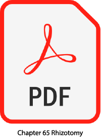 PDF Icon for Chapter 65 Rhiztomy